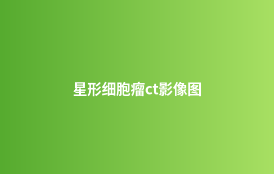 星形细胞瘤ct影像图