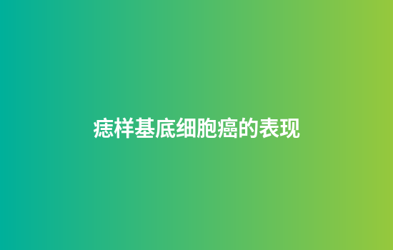 痣样基底细胞癌的表现